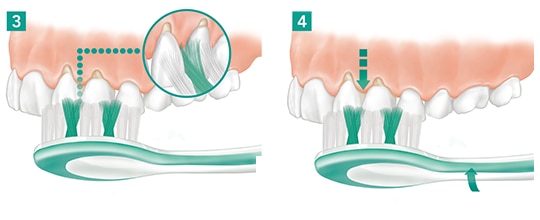 Ilustrace techniky čištění zubů zaměřená na čištění pod správným úhlem.