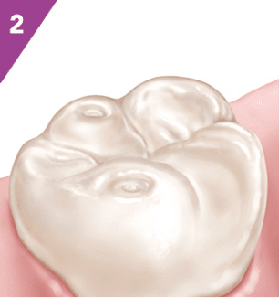 Detailní ilustrace zubu s důrazem na čistotu a strukturu skloviny.
