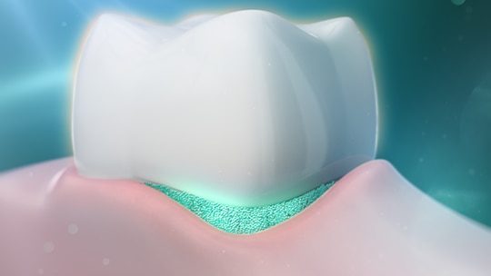 Detail zubu a dásně ilustrující ústní hygienu.
