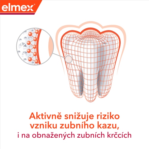 Ilutrace zubu s popisem o snížení rizika vzniku zubního kazu, i na obnažených zubních krčcích