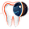 Počáteční kaz