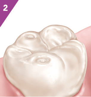 Detailní ilustrace zubu s důrazem na čistotu a strukturu skloviny. Detailní ilustrace zubu s důrazem na čistotu a strukturu skloviny.