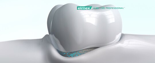 Jak PRO-ARGIN® pomáhá při zvýšené citlivosti zubů? Jak PRO-ARGIN® pomáhá při zvýšené citlivosti zubů?